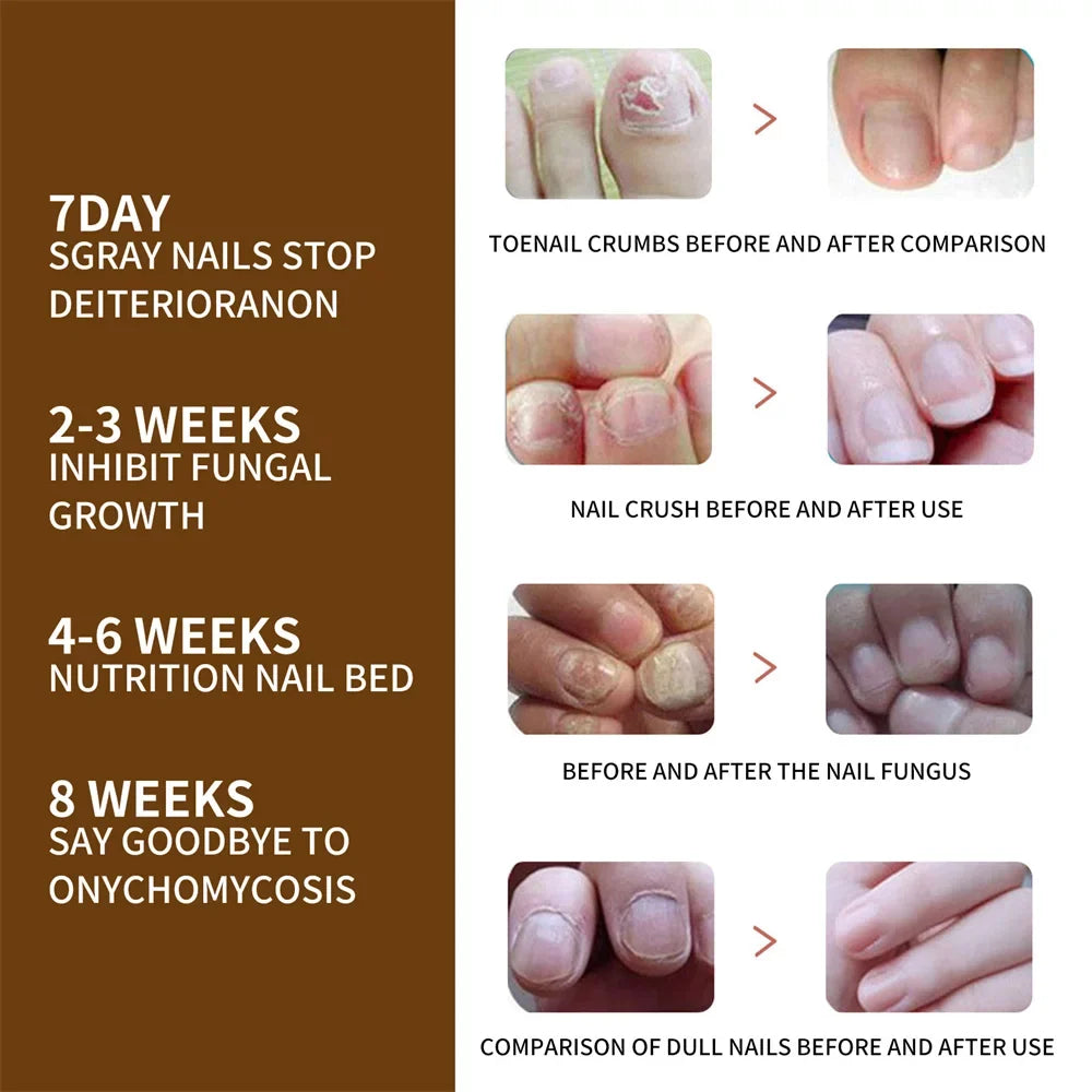 30ml Nail Organic DeepHealing Growth 2pcs Serum