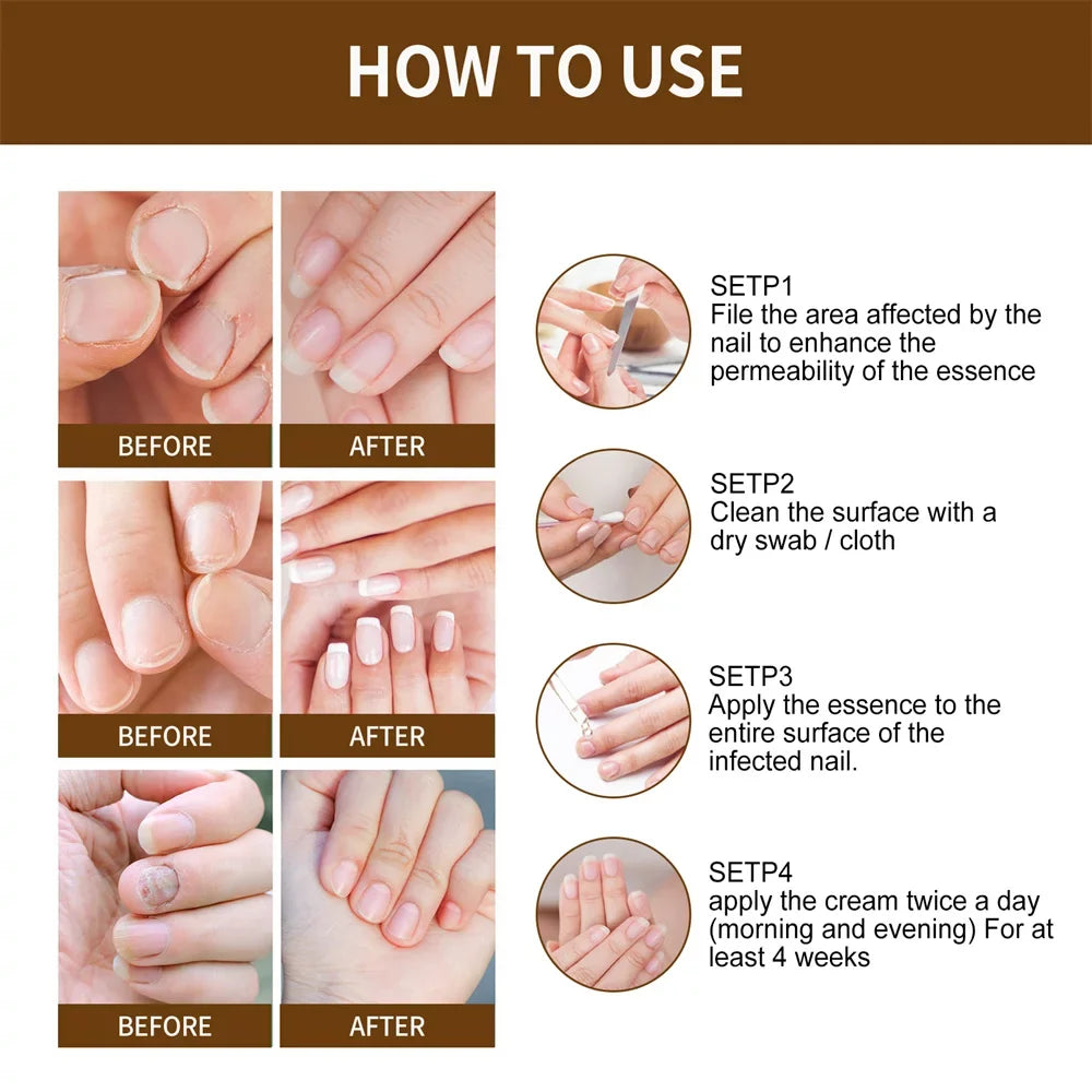 30ml Nail Organic DeepHealing Growth 2pcs Serum